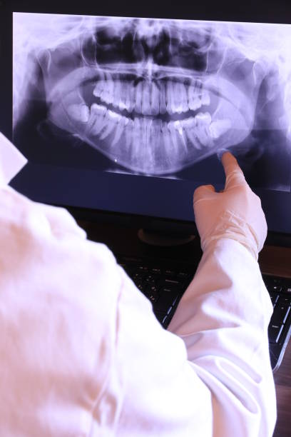 Best Emergency Dental Care for Abscessed Tooth in Wyndmoor, PA