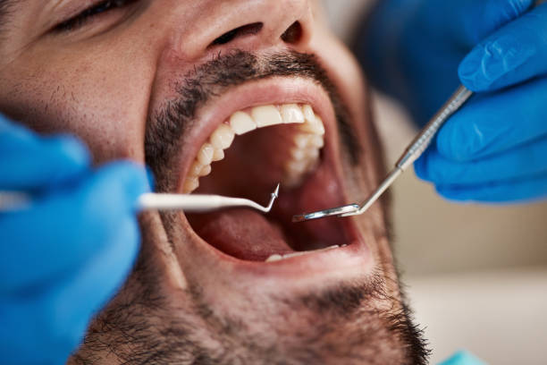 Best Emergency Dental Services for Seniors in Wyndmoor, PA